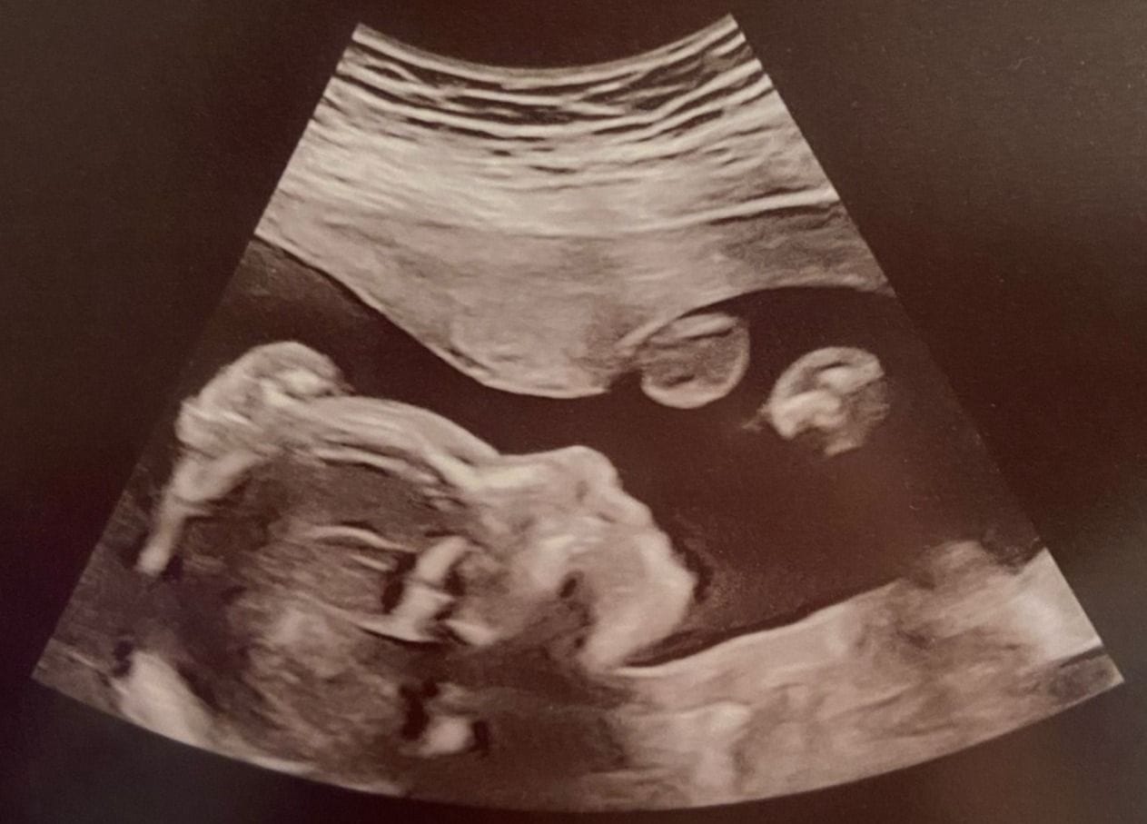 501453661_18355960597194430_2759075792822502392_n