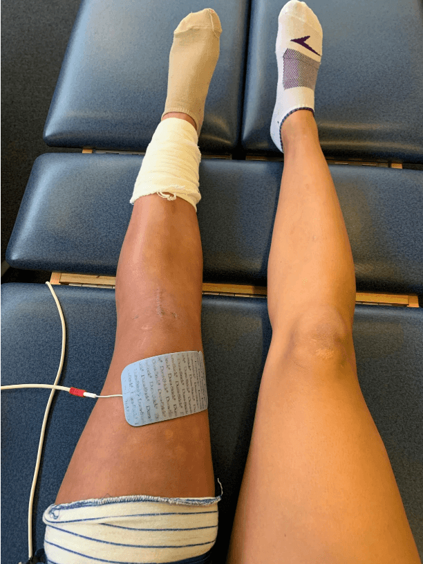 Marley's legs resting and wrapped up during physical therapy